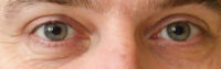 Ausschnitt: Todd Brabenders Augen, mit nicht ganz kreisförmigen Pupillen